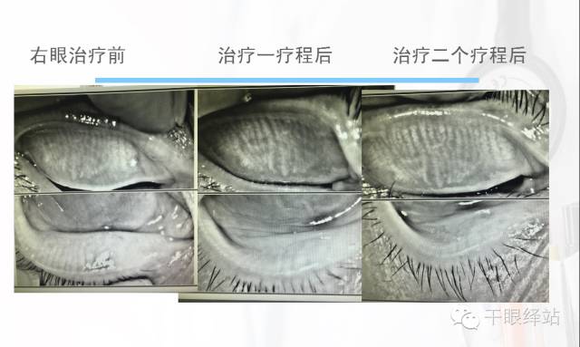 愛爾眼科醫(yī)院